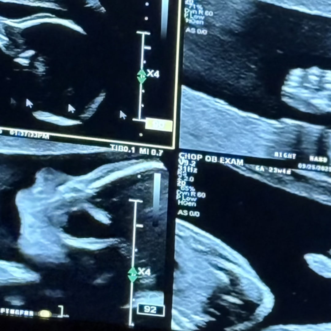 Photo shared by Jacqueline for their Babylist baby registry.