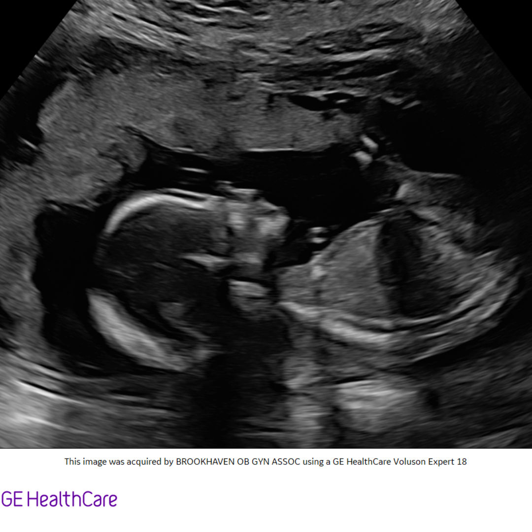 Photo shared by Alyssa for their Babylist baby registry.