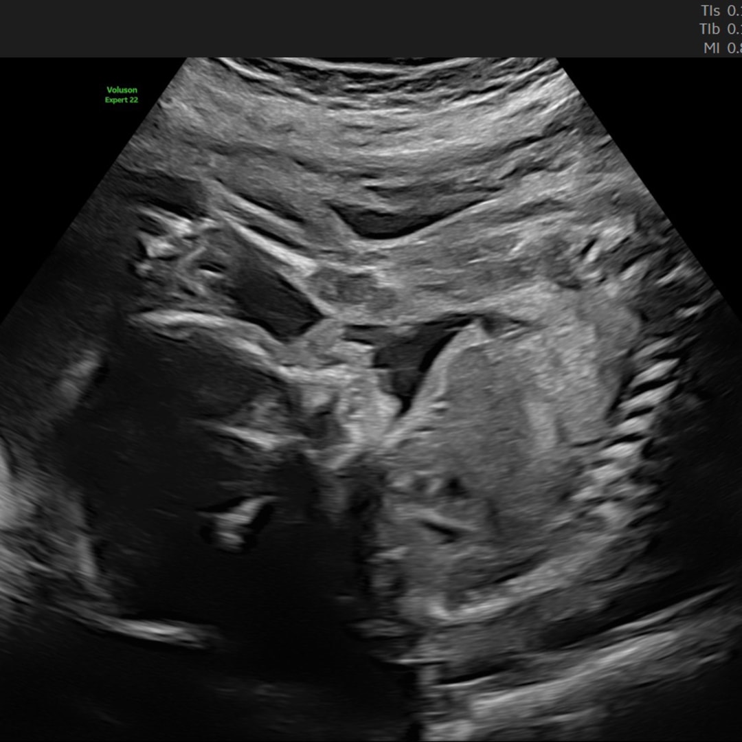 Photo shared by Karen for their Babylist baby registry.