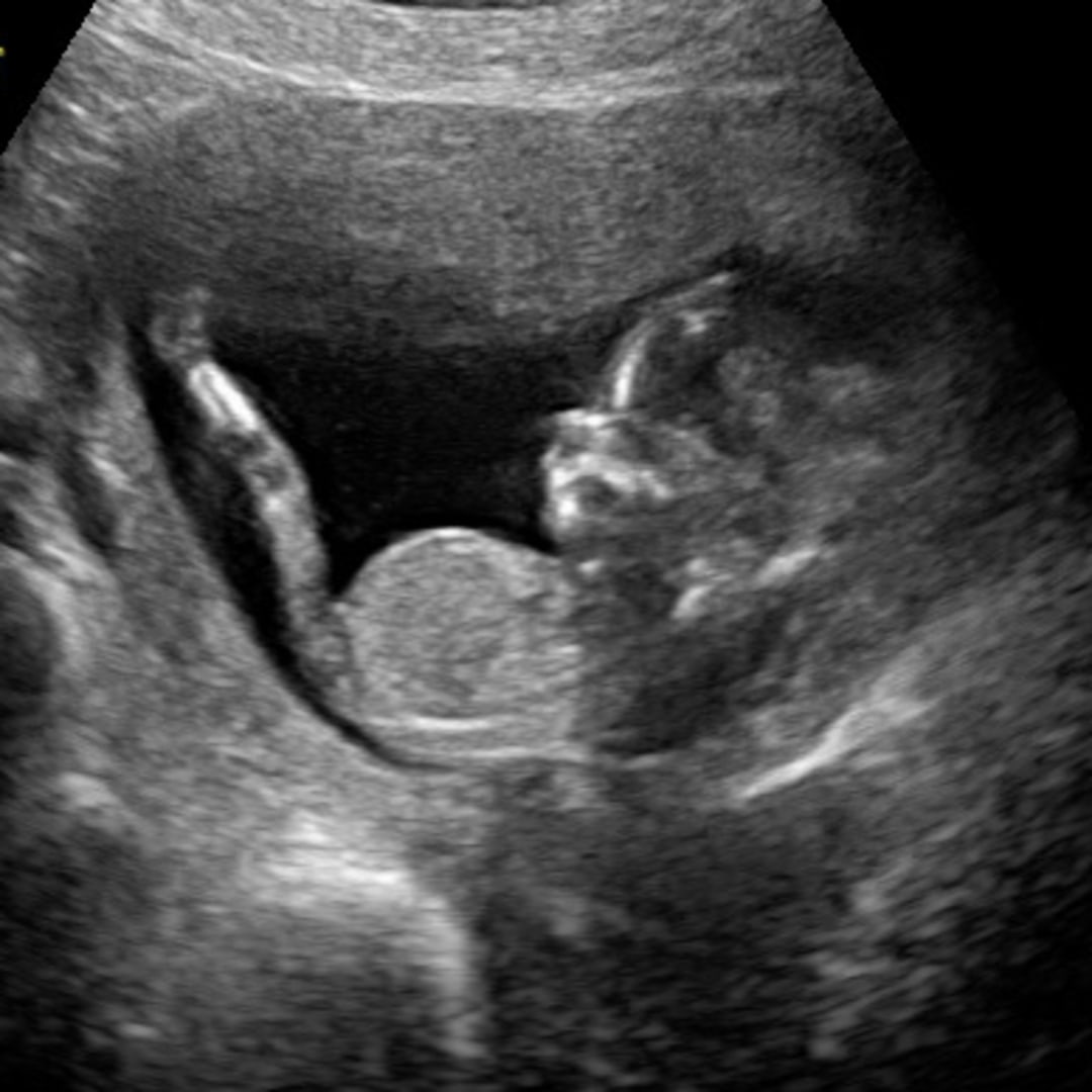 Photo shared by Ashley for their Babylist baby registry.