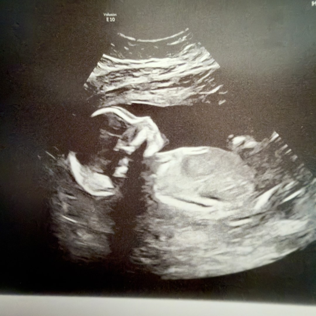 Photo shared by Dayleen for their Babylist baby registry.