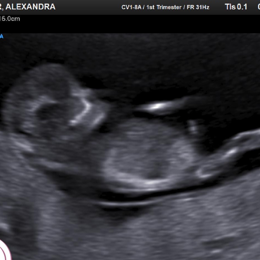 Photo shared by Alexandra for their Babylist baby registry.