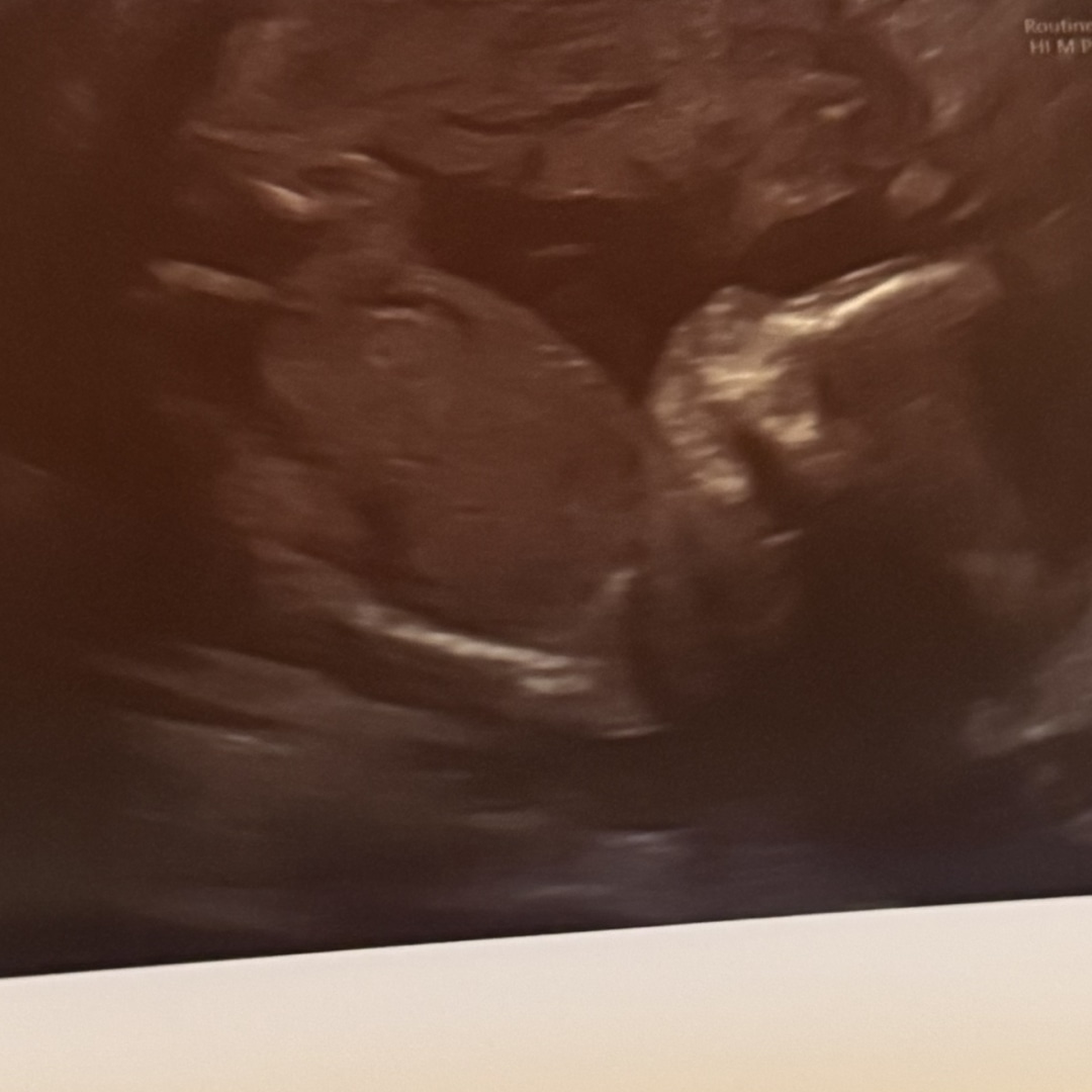 Photo shared by Peyton for their Babylist baby registry.