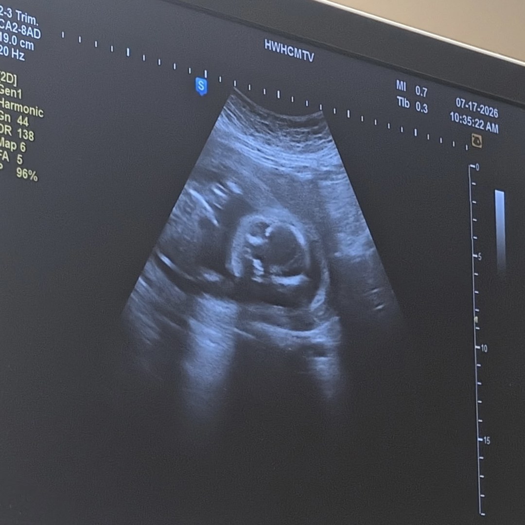 Photo shared by Hailey for their Babylist baby registry.