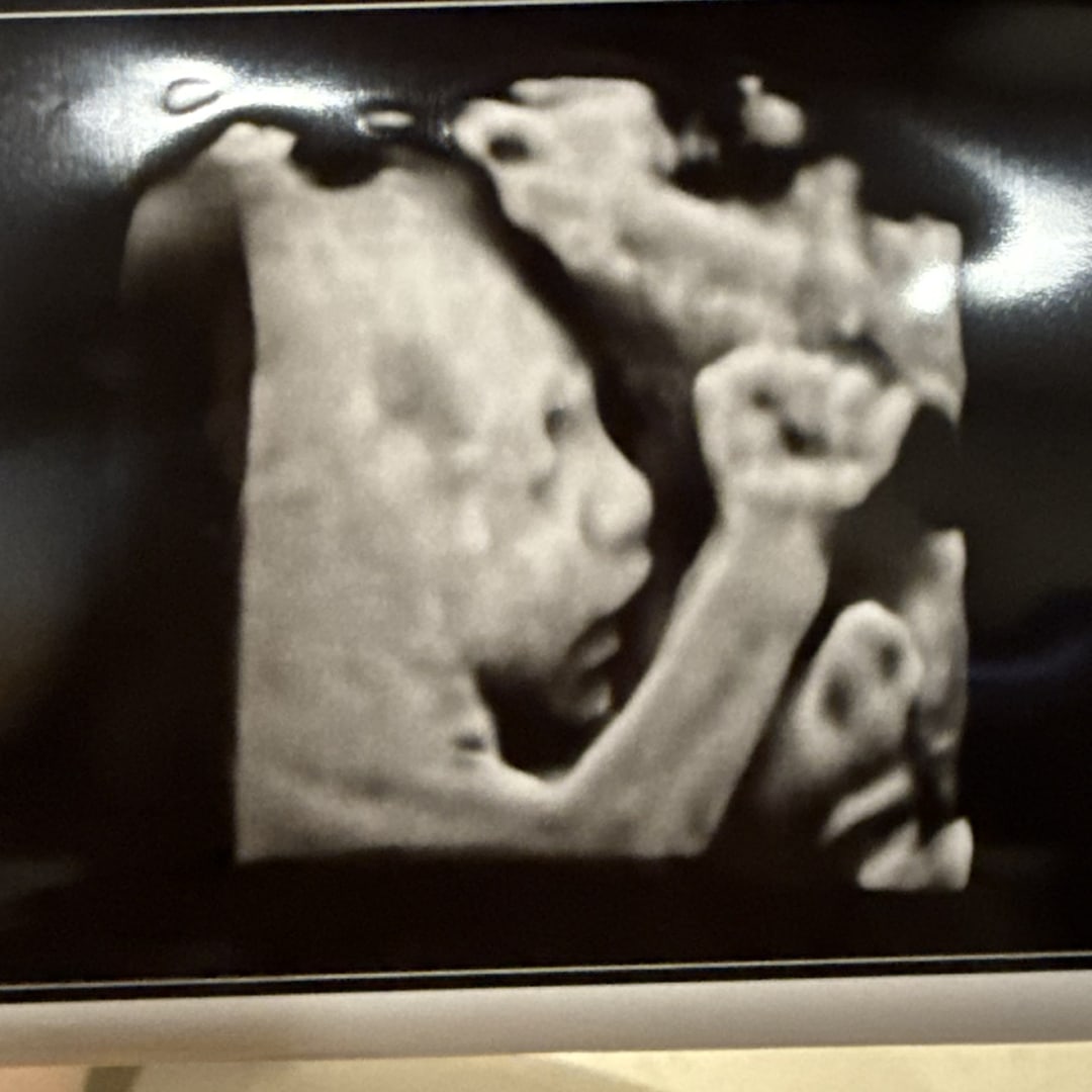 Photo shared by Gileen for their Babylist baby registry.
