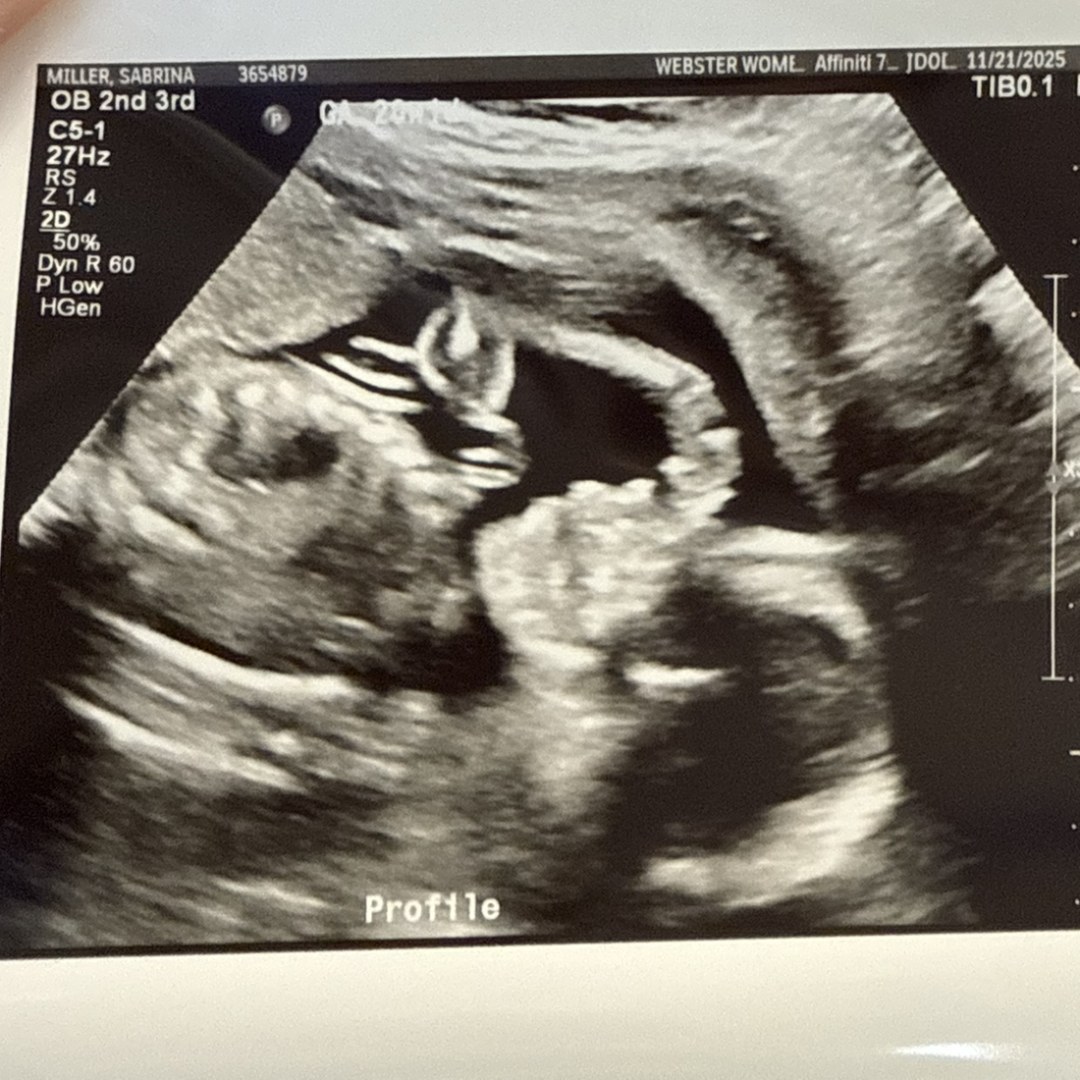 Photo shared by Sabrina for their Babylist baby registry.