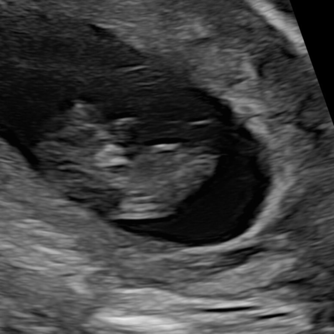 Photo shared by Dulce for their Babylist baby registry.