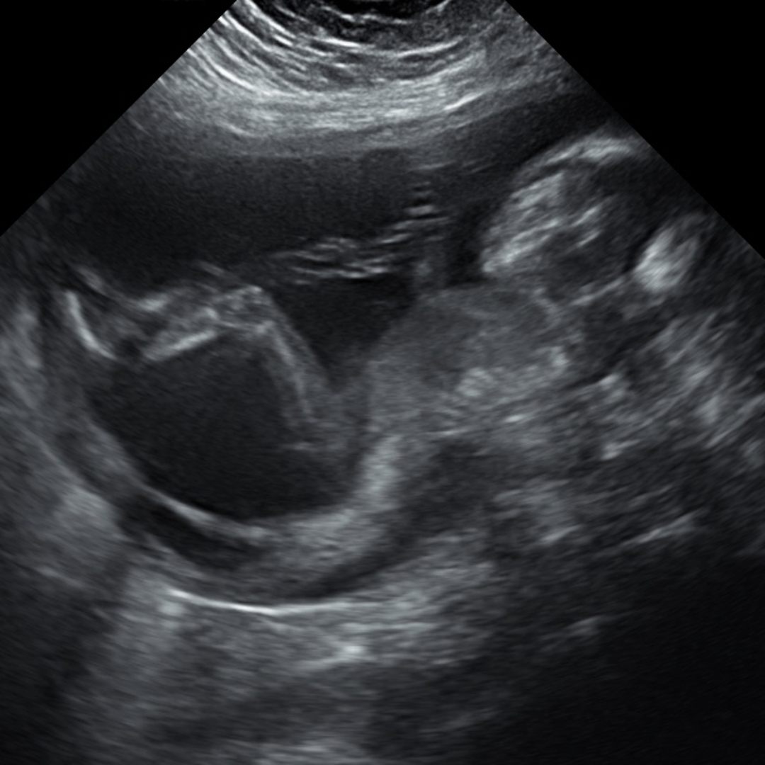 Photo shared by Alexis for their Babylist baby registry.