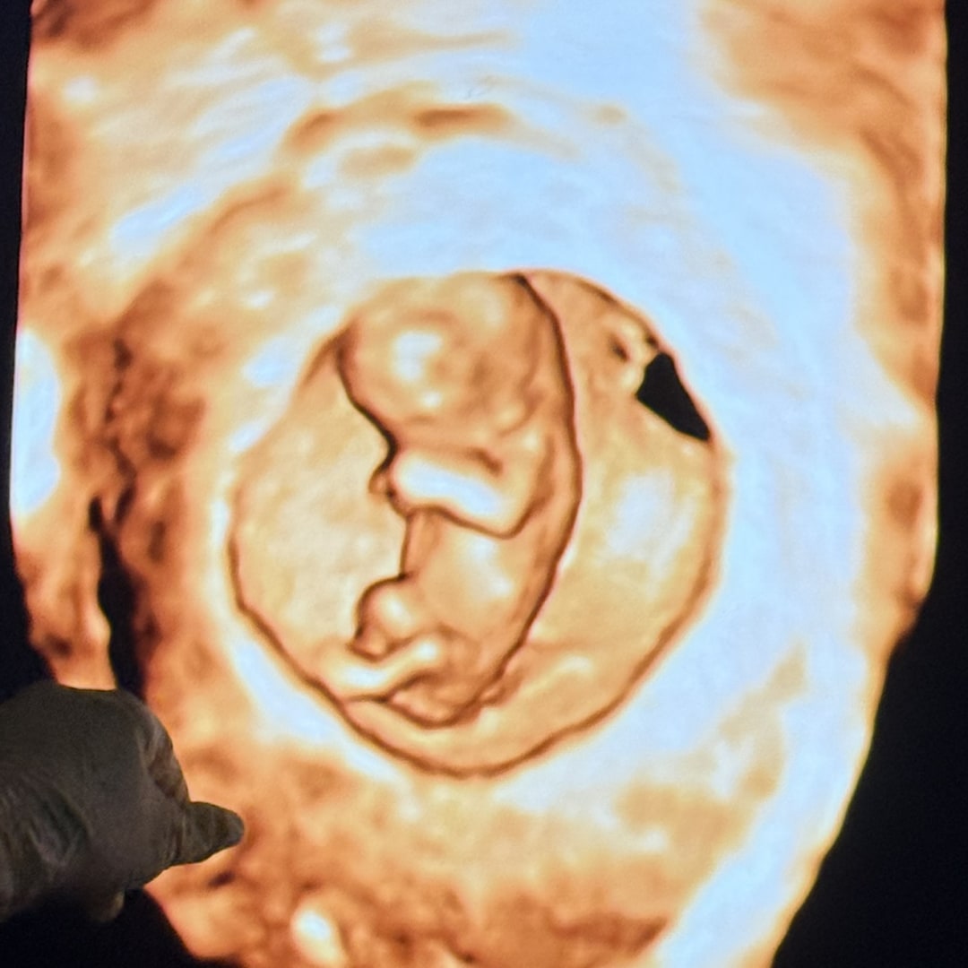 Photo shared by Jenna for their Babylist baby registry.