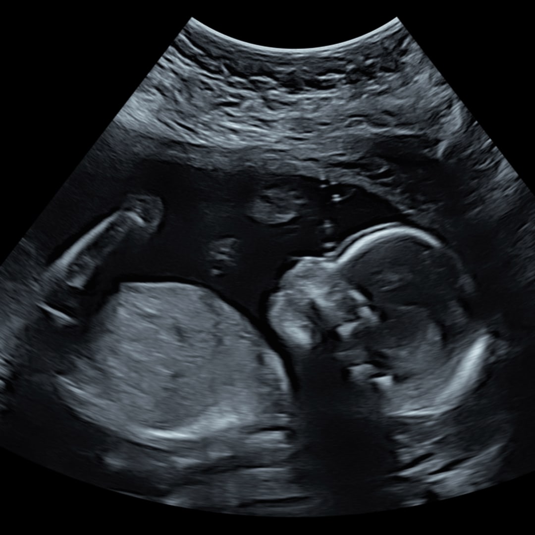 Photo shared by Amelia for their Babylist baby registry.