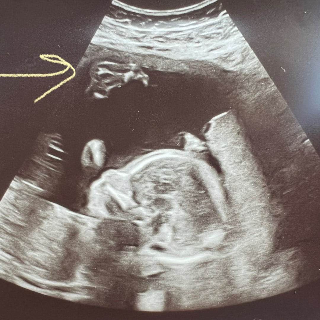 Photo shared by Jess for their Babylist baby registry.