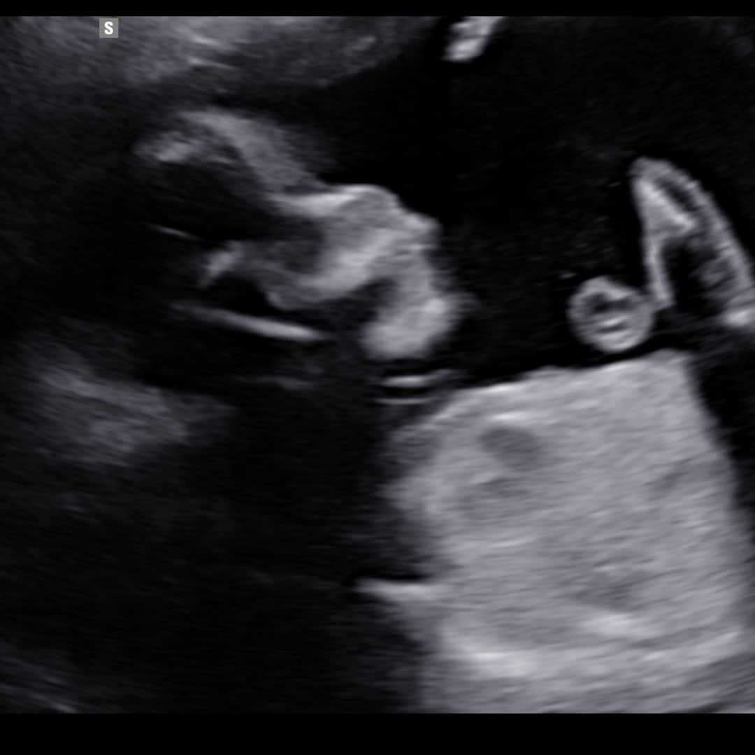 Photo shared by Bailey for their Babylist baby registry.