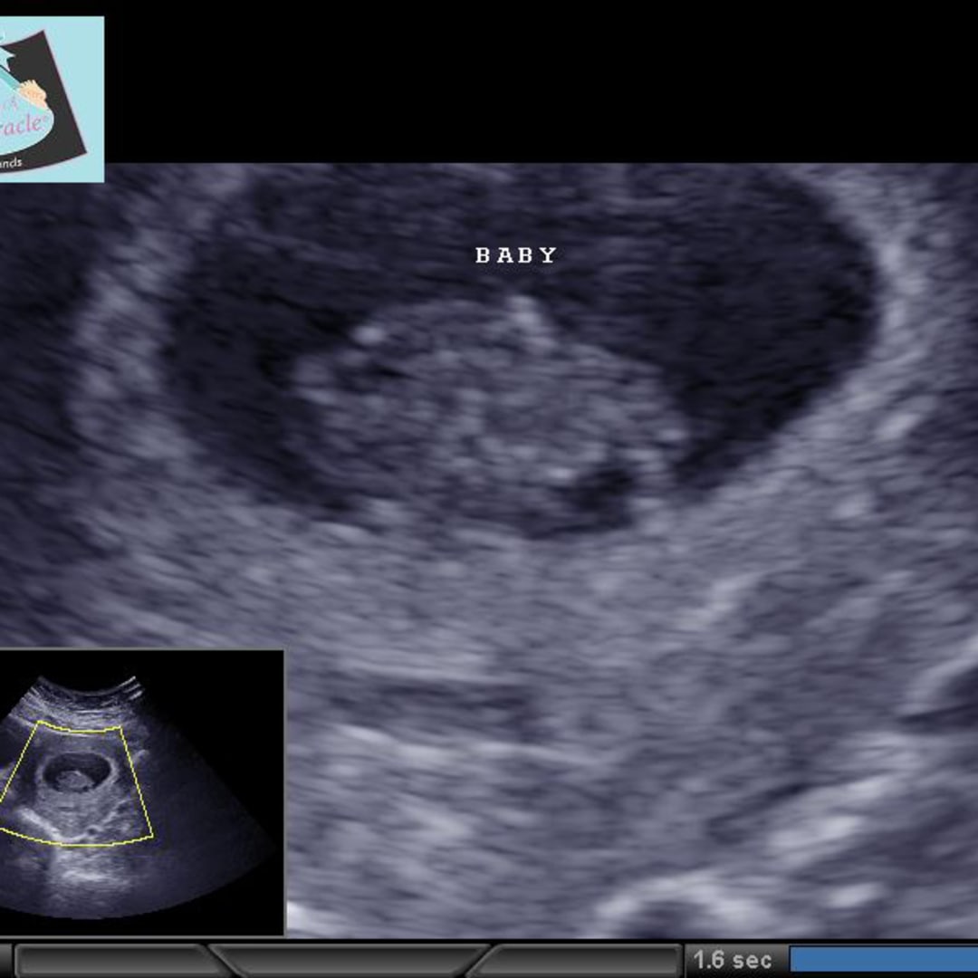 Photo shared by Darlene for their Babylist baby registry.