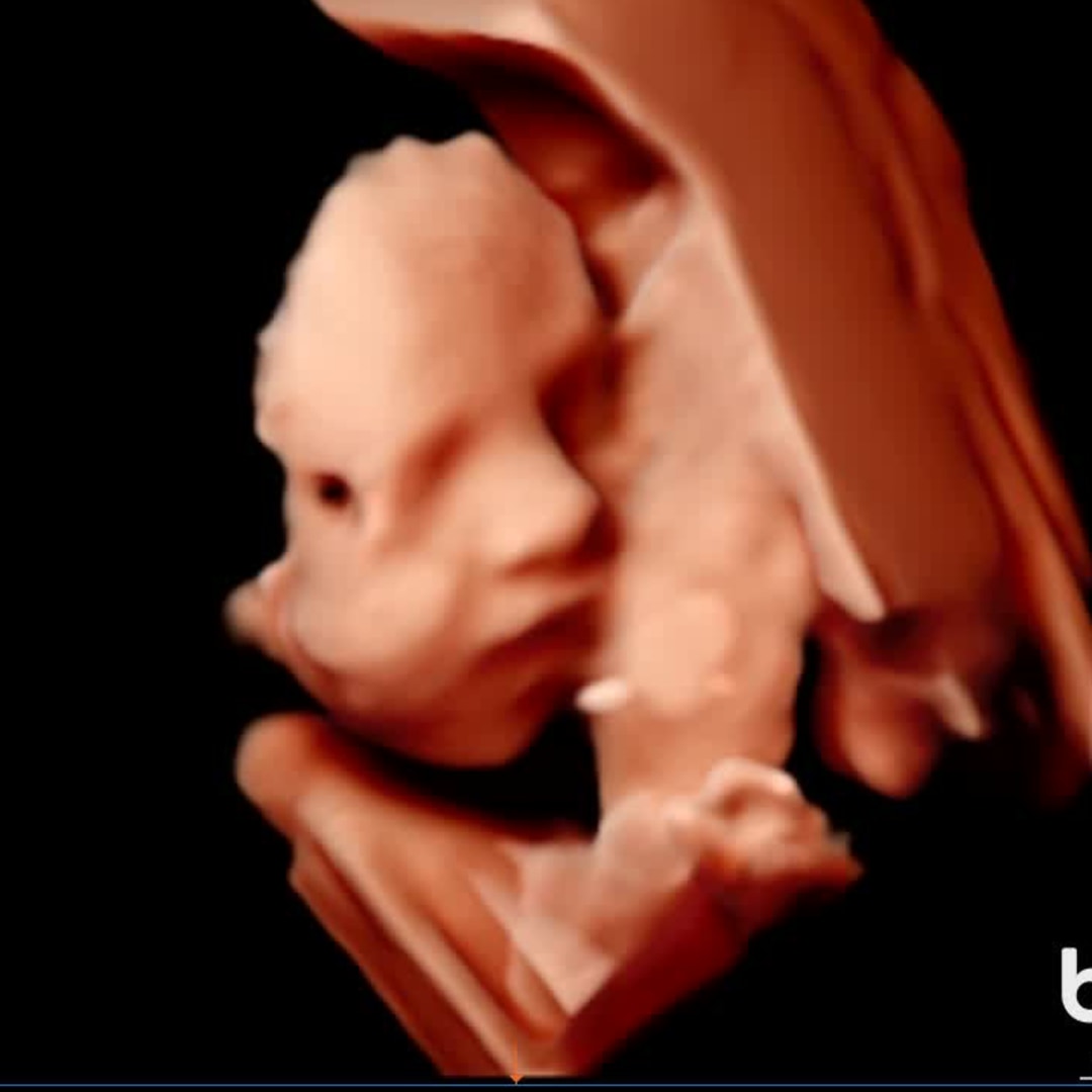 Photo shared by Cadie for their Babylist baby registry.