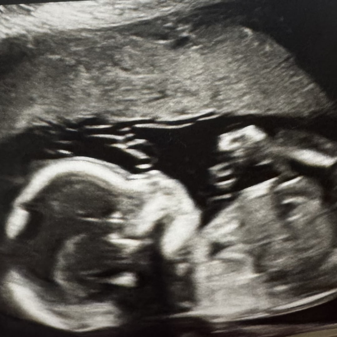 Photo shared by Madilyn for their Babylist baby registry.