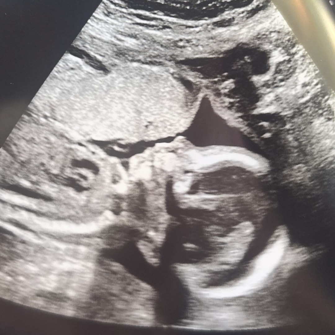 Photo shared by Karla for their Babylist baby registry.