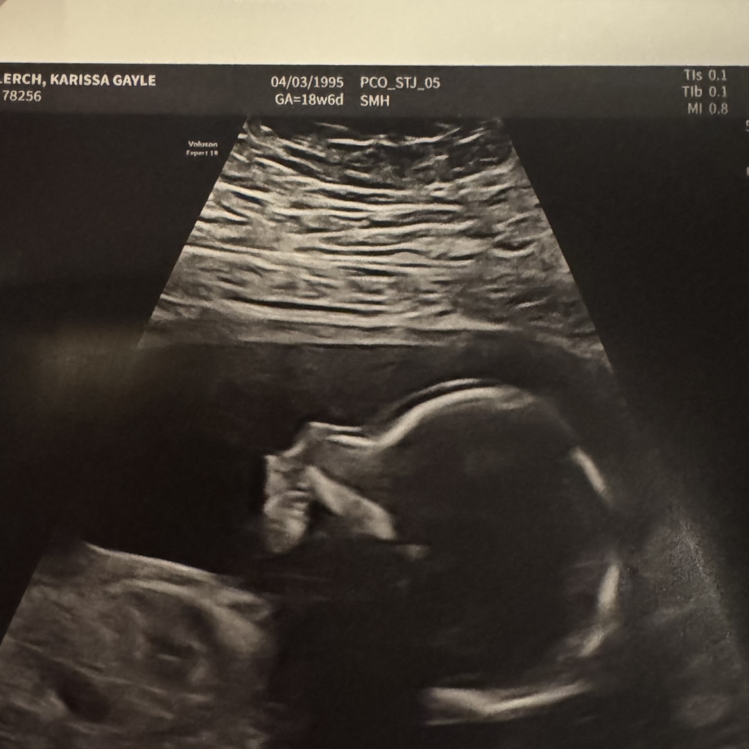 Photo shared by Karissa for their Babylist baby registry.