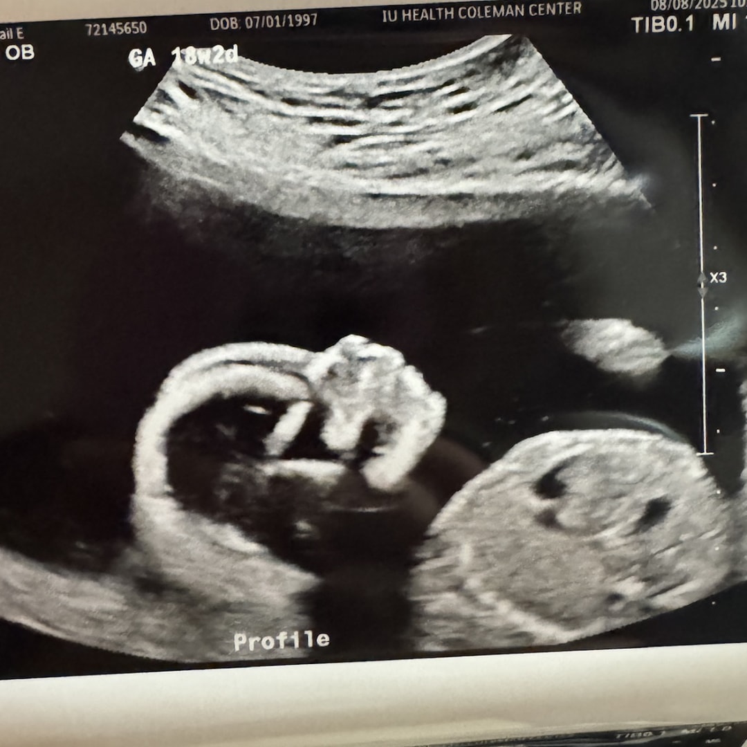 Photo shared by Abi for their Babylist baby registry.