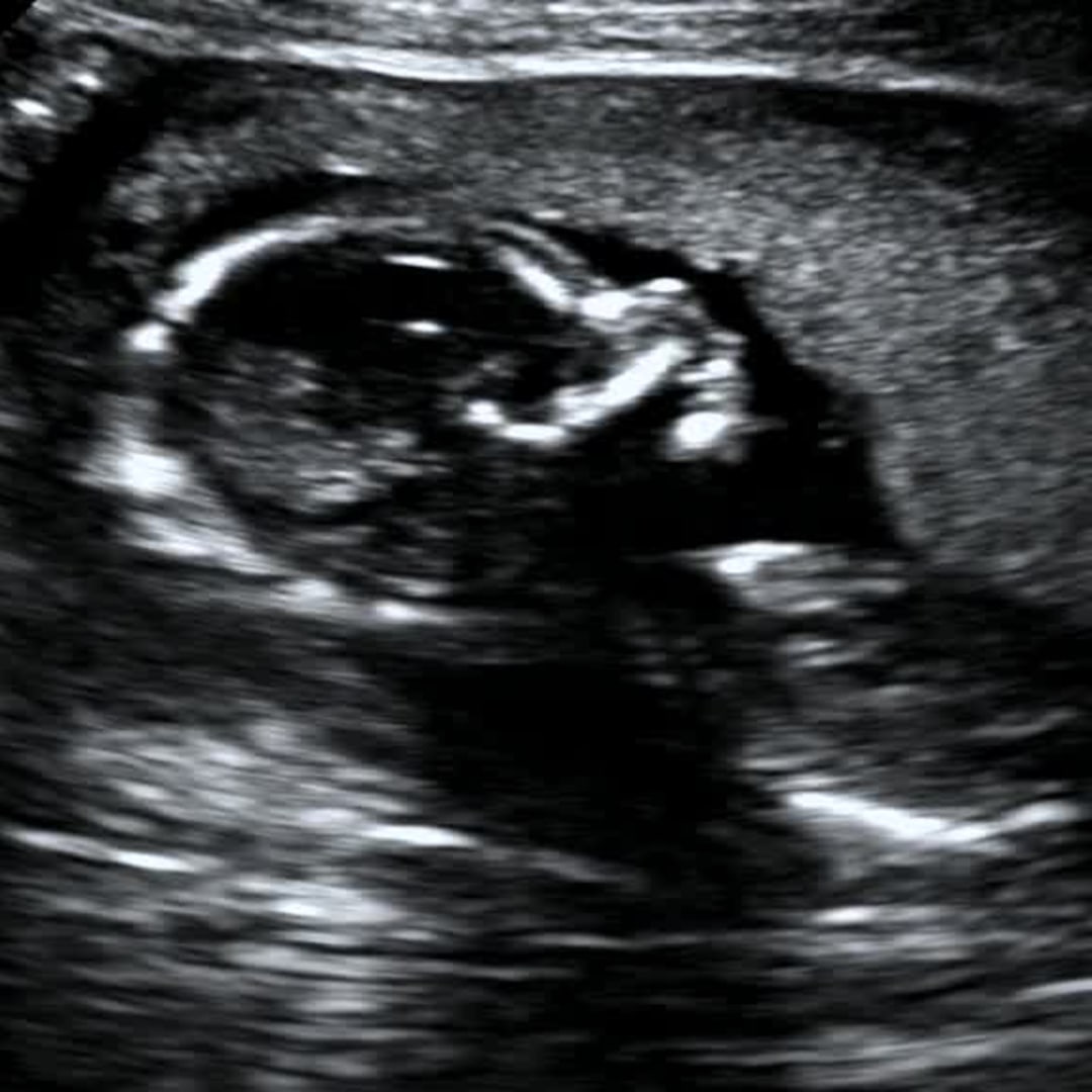 Photo shared by Bria for their Babylist baby registry.