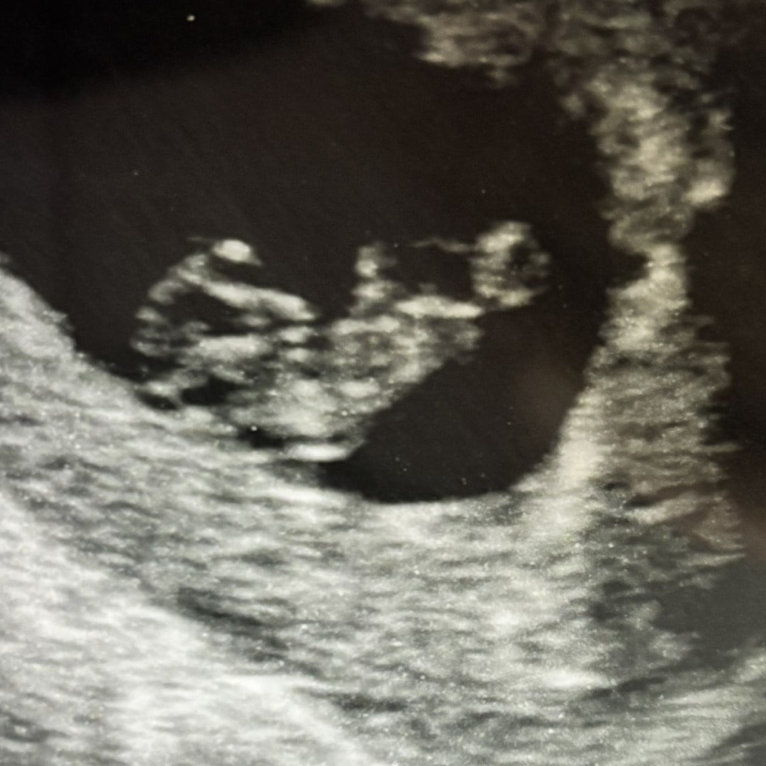 Photo shared by Ashley for their Babylist baby registry.