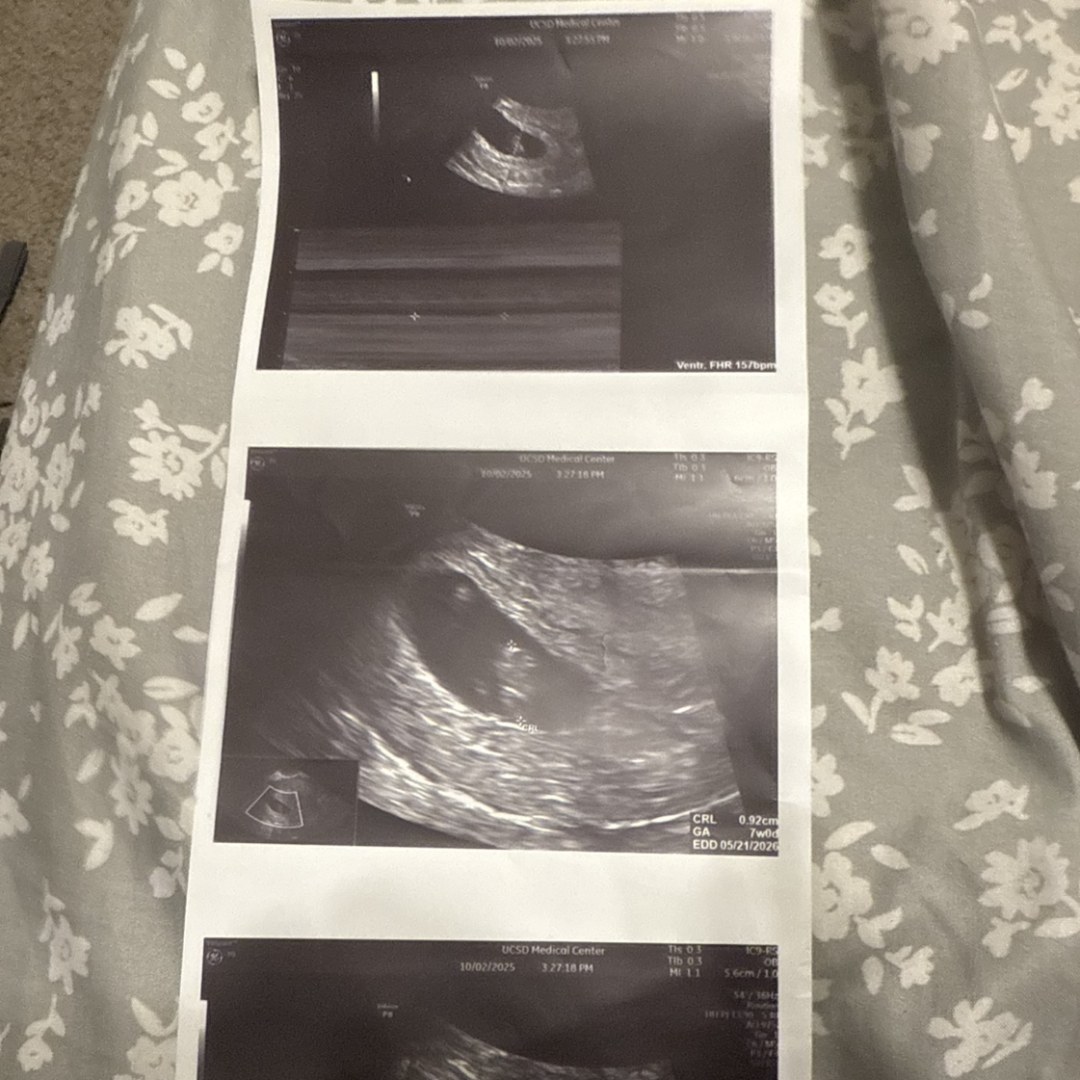 Photo shared by Elizabeth for their Babylist baby registry.