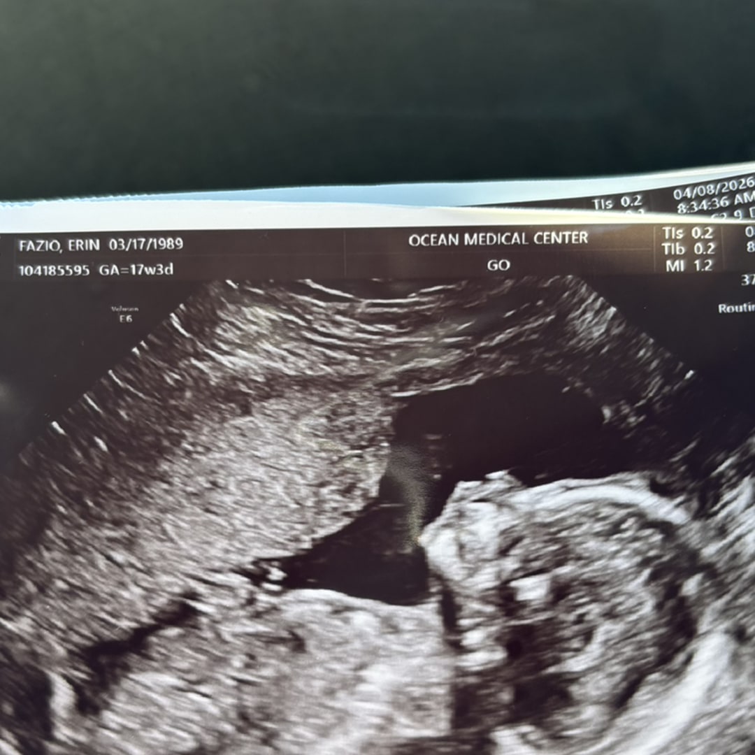 Photo shared by Erin for their Babylist baby registry.
