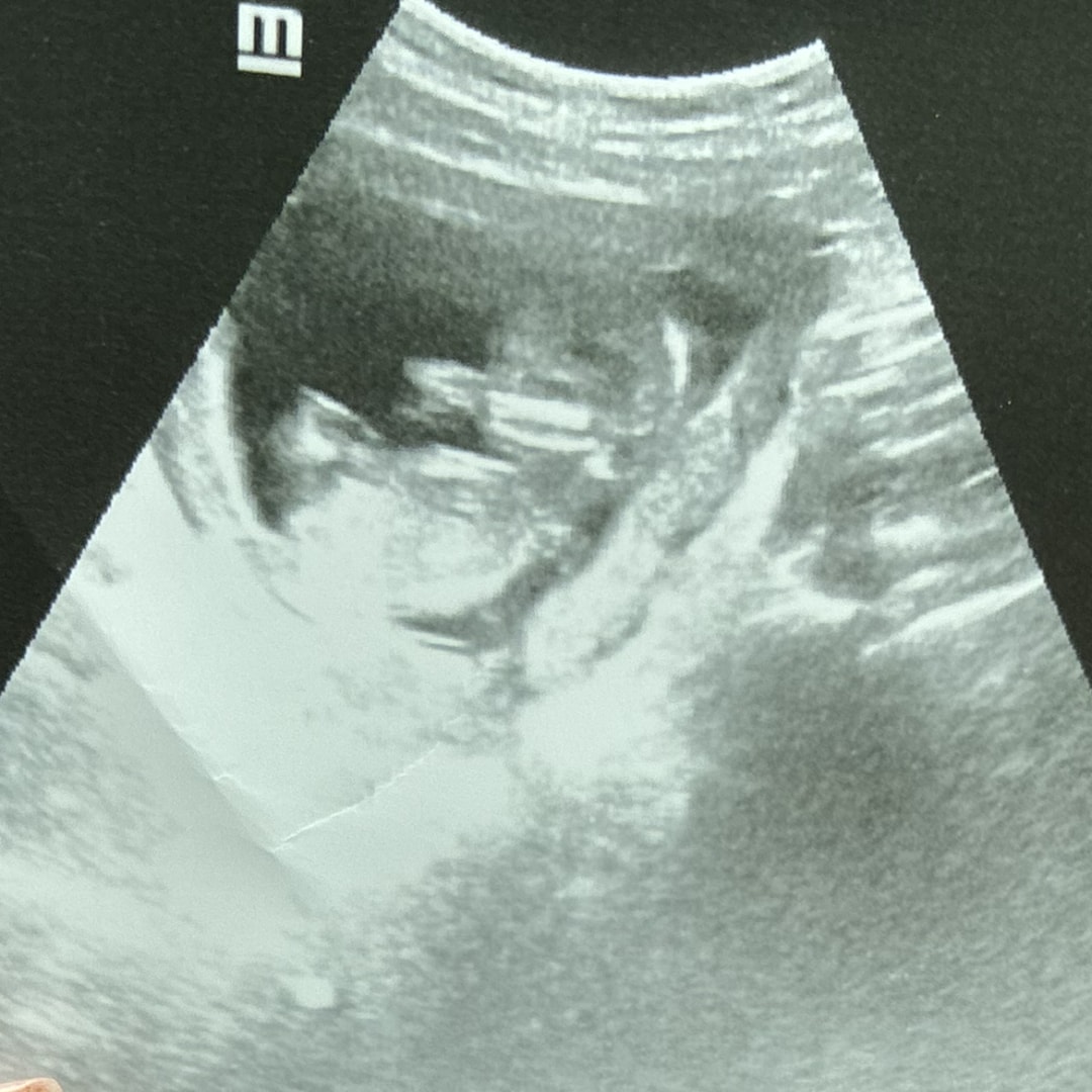 Photo shared by Chazlyn for their Babylist baby registry.