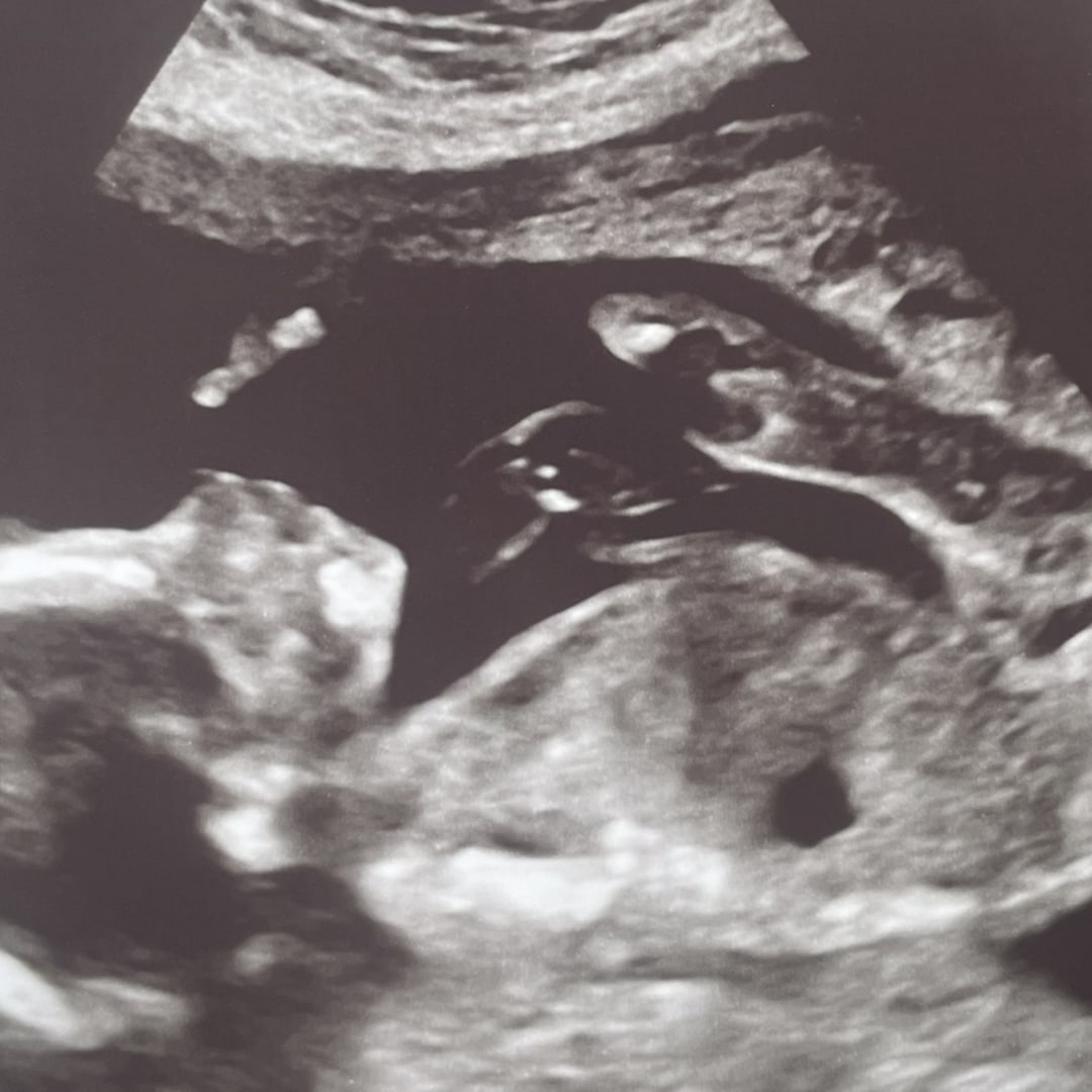 Photo shared by Andrea for their Babylist baby registry.