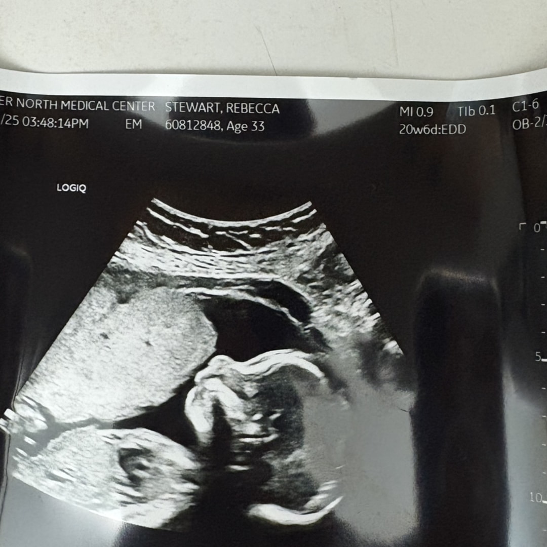 Photo shared by Becky for their Babylist baby registry.