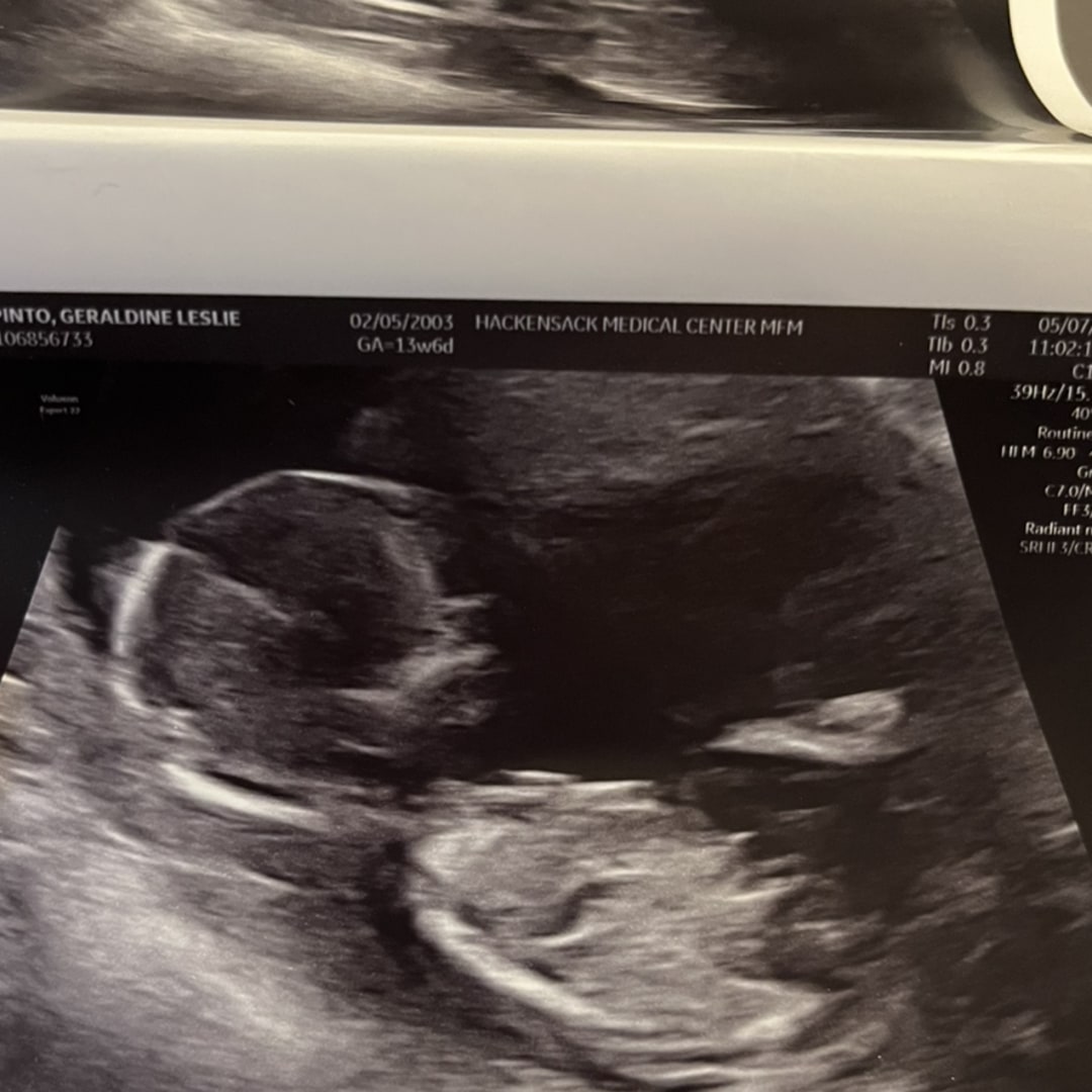 Photo shared by Geraldine for their Babylist baby registry.