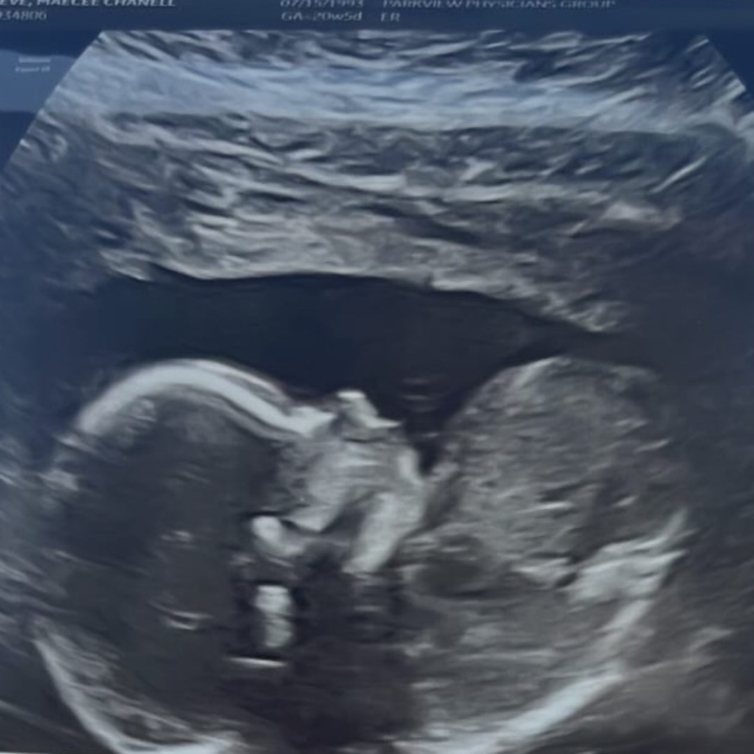 Photo shared by Maecee for their Babylist baby registry.