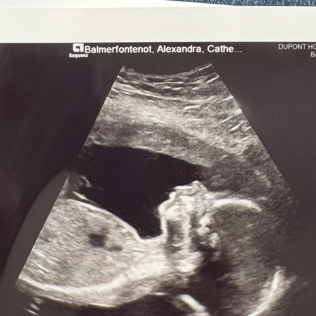 Photo shared by Alexandra for their Babylist baby registry.