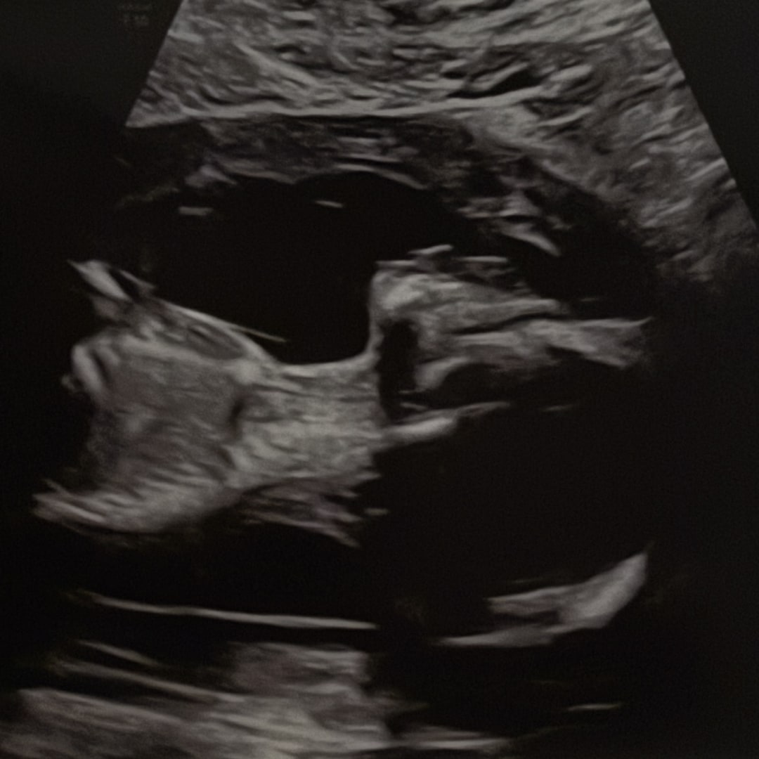Photo shared by Andeisha for their Babylist baby registry.