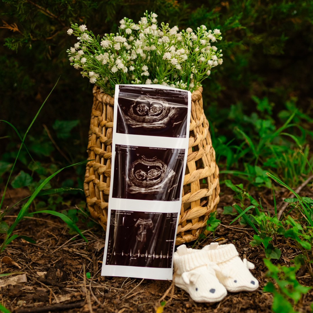 Photo shared by Emily for their Babylist baby registry.