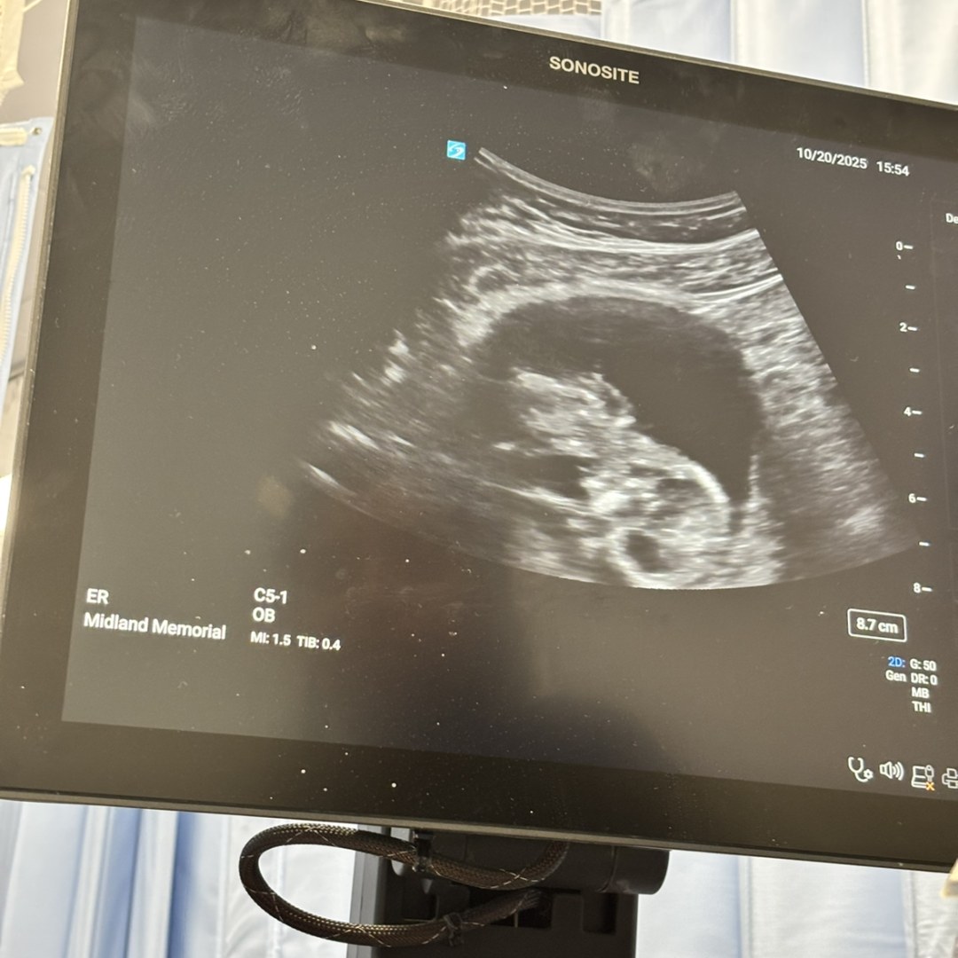 Photo shared by Maria for their Babylist baby registry.