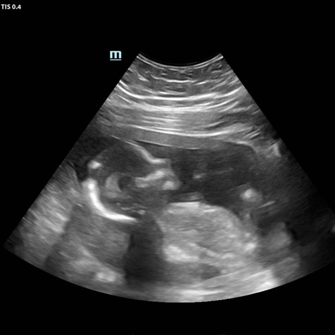 Photo shared by Ambra for their Babylist baby registry.