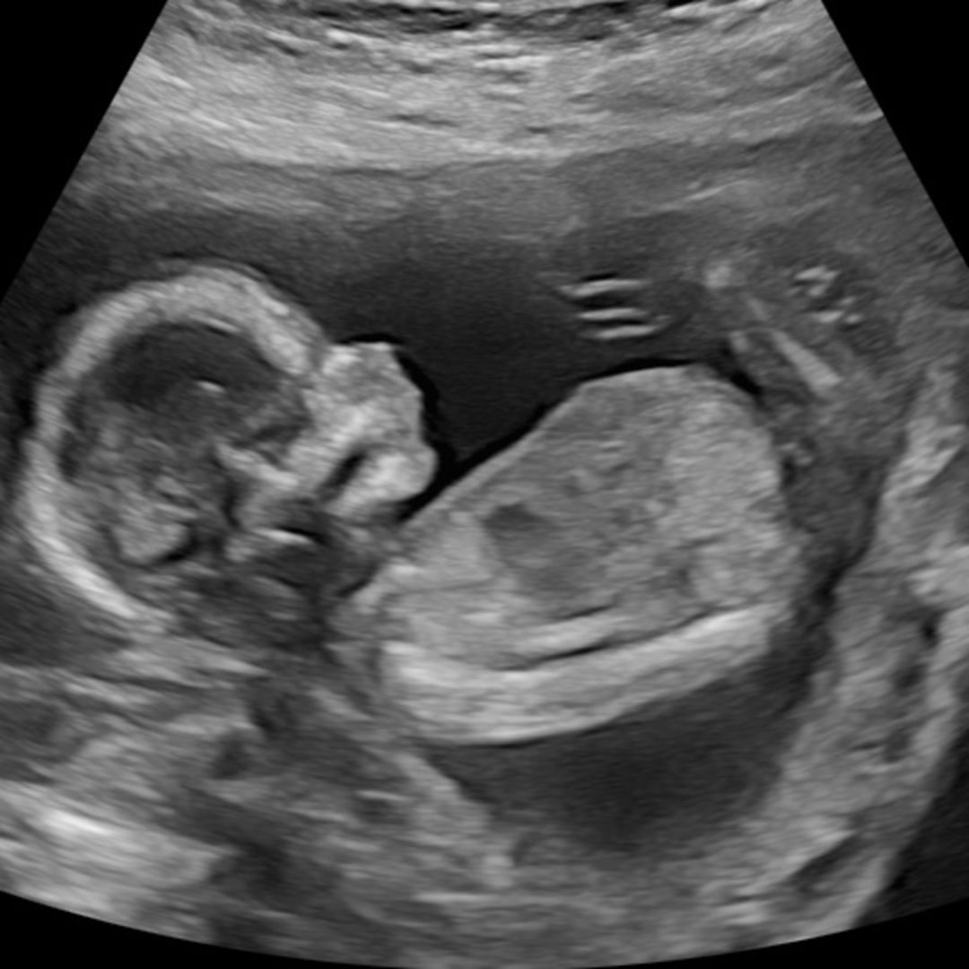 Photo shared by Taylor for their Babylist baby registry.