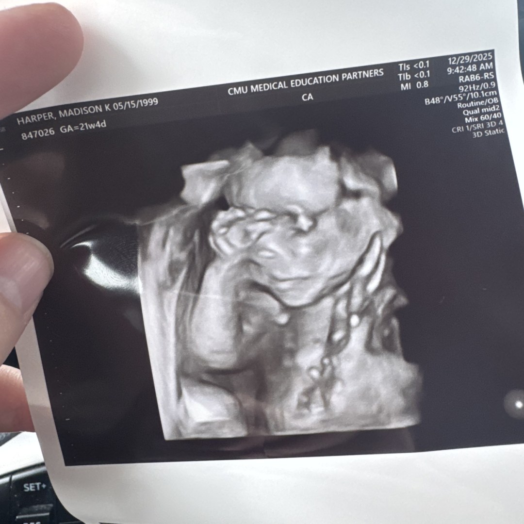Photo shared by Maddie for their Babylist baby registry.