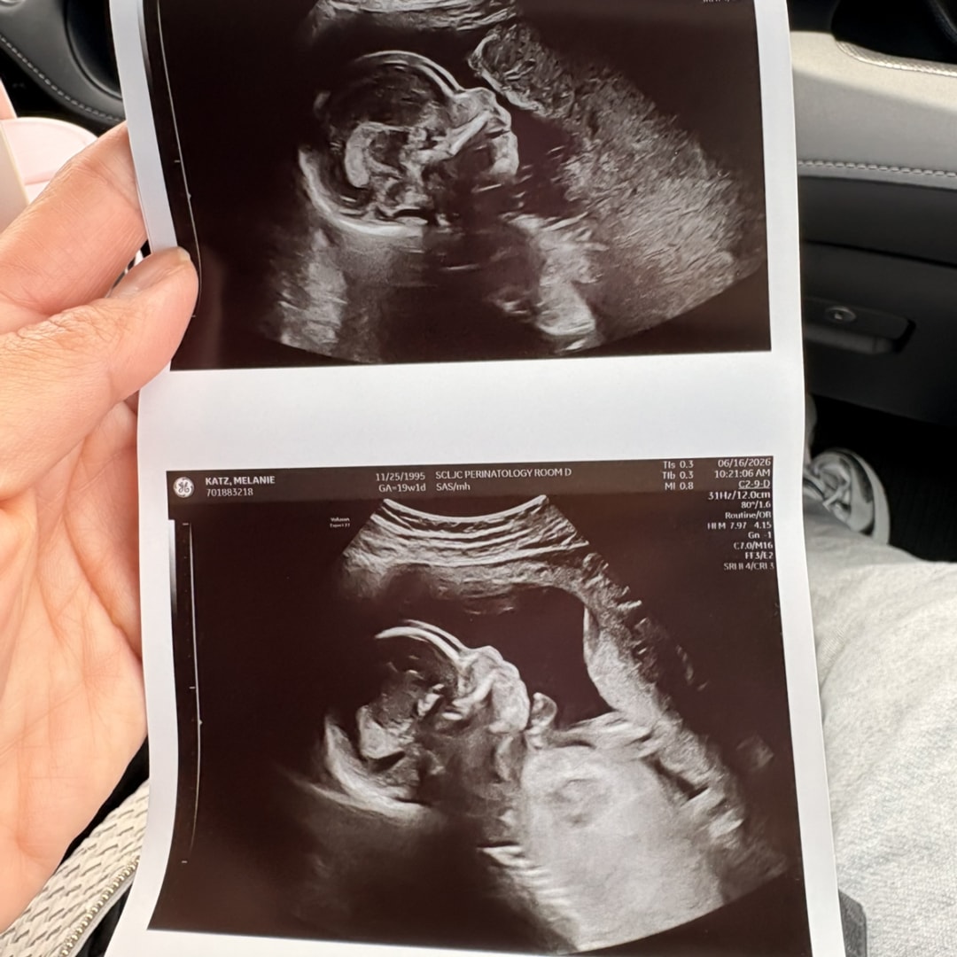Photo shared by Mel for their Babylist baby registry.