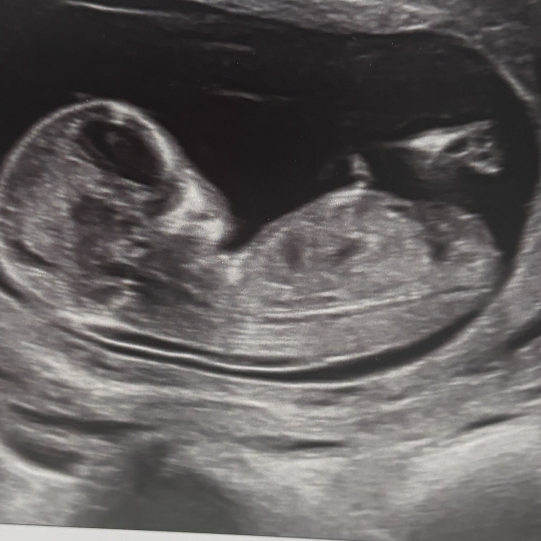 Photo shared by Liron for their Babylist baby registry.