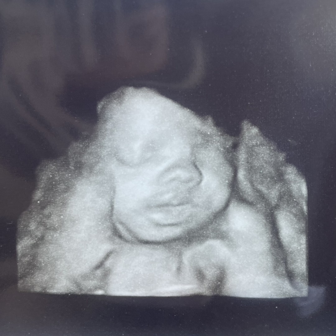 Photo shared by Amy for their Babylist baby registry.