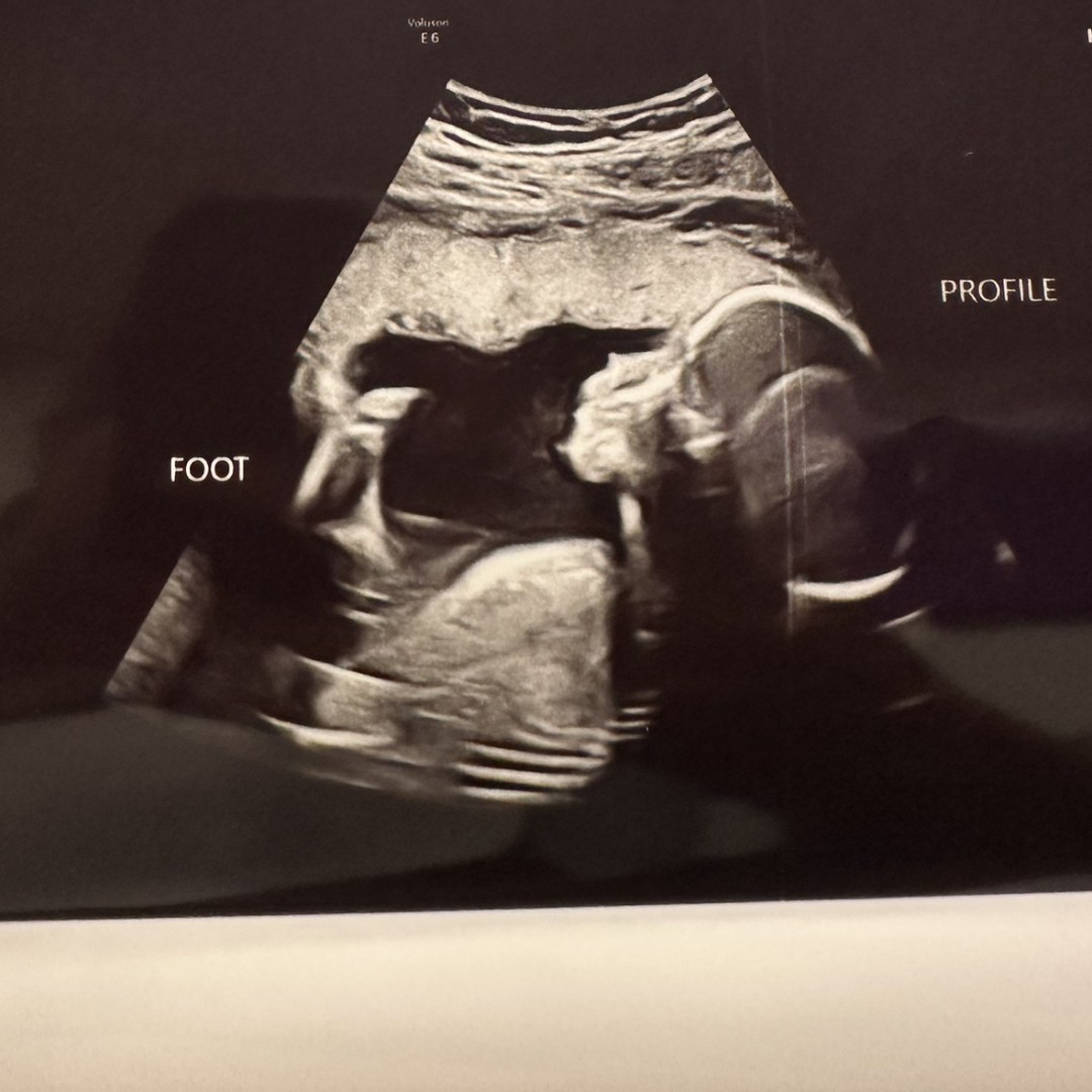 Photo shared by Briauna for their Babylist baby registry.