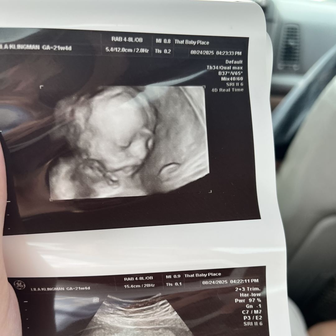 Photo shared by Lila for their Babylist baby registry.