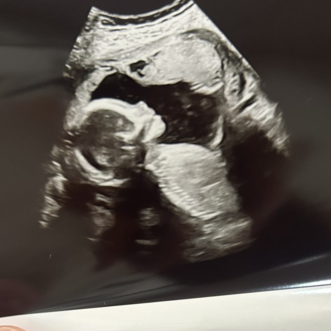 Photo shared by Hollie for their Babylist baby registry.