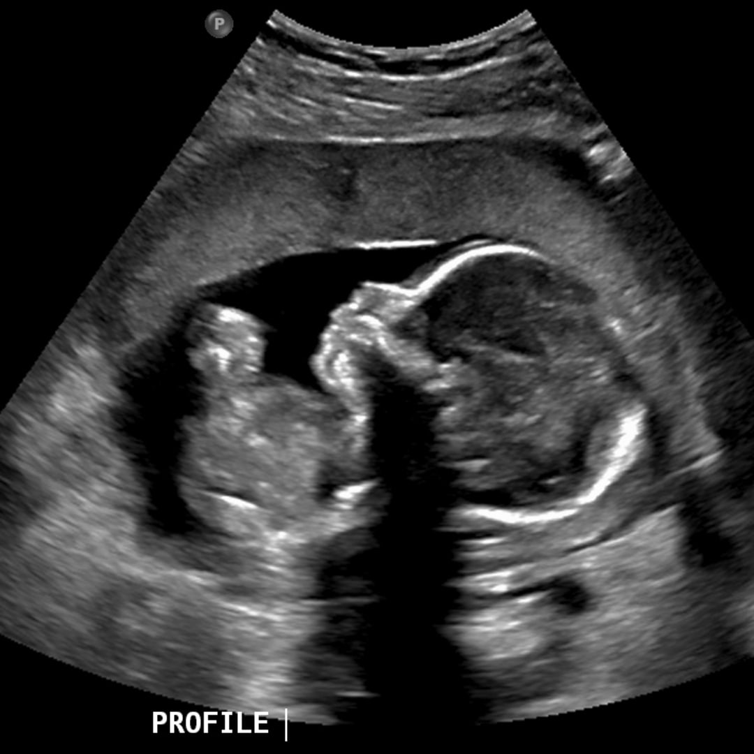 Photo shared by Kasia for their Babylist baby registry.