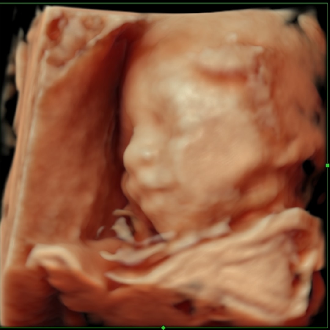 Photo shared by Kaylee for their Babylist baby registry.
