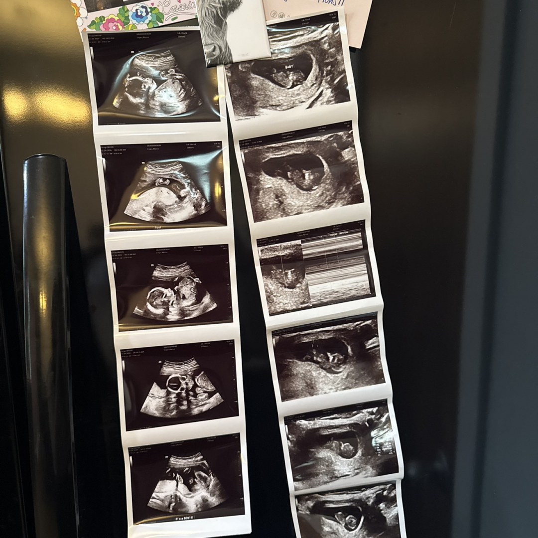 Photo shared by Alyssa for their Babylist baby registry.