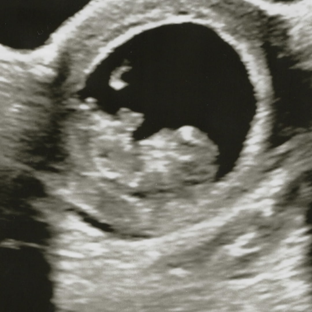 Photo shared by Jewly for their Babylist baby registry.