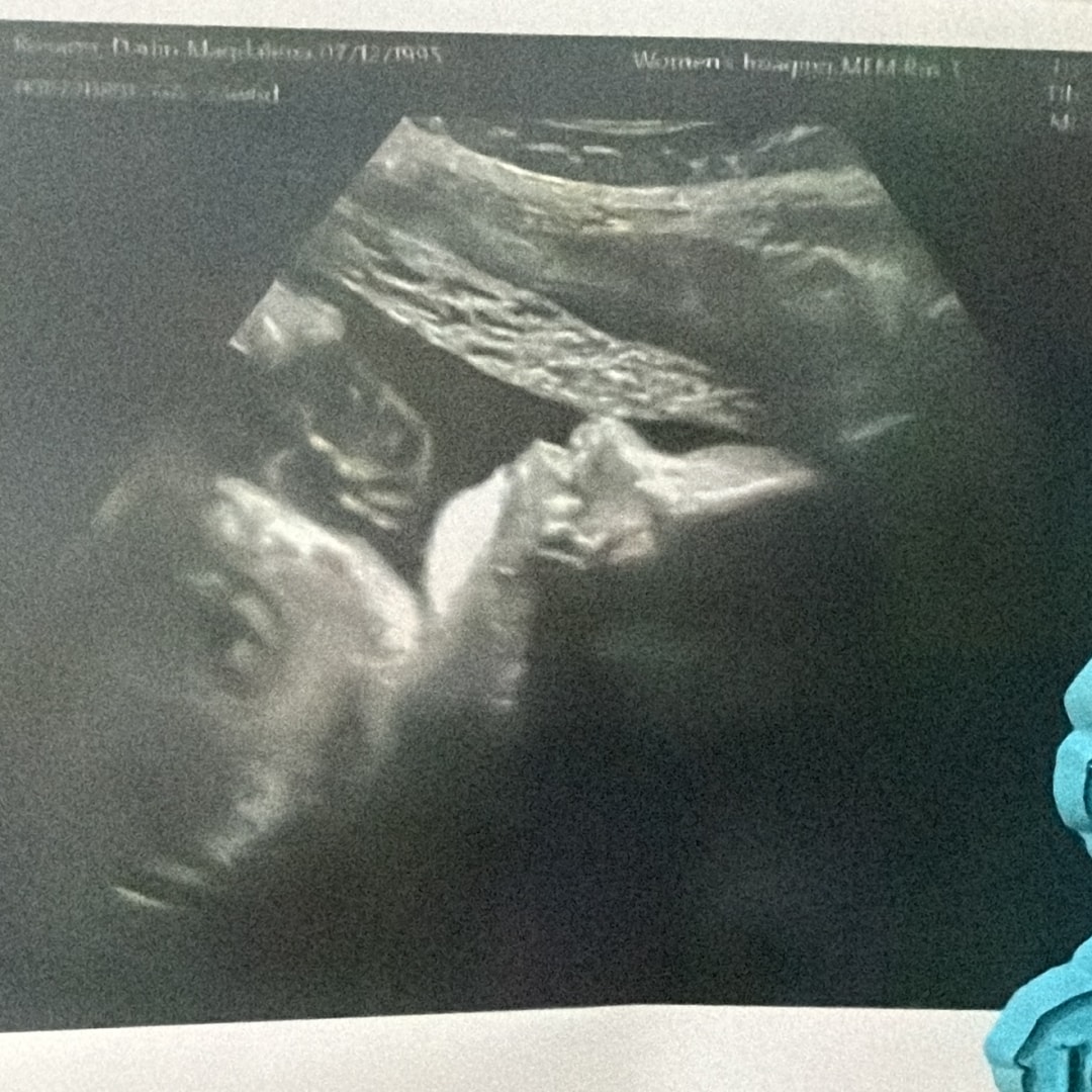 Photo shared by Darlin for their Babylist baby registry.