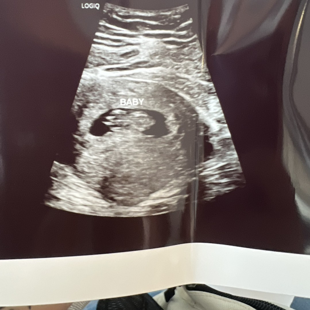 Photo shared by Elizabeth for their Babylist baby registry.